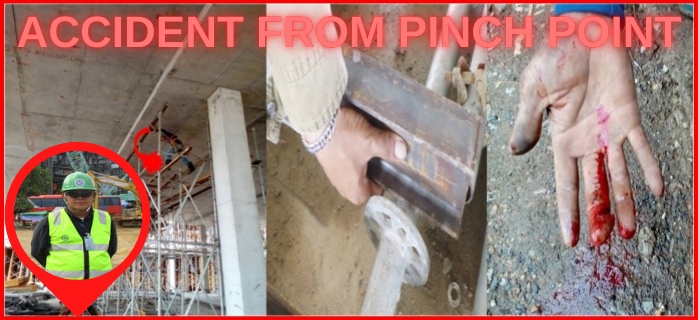 Accident from Pinch Point