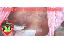 Accident from Hot Works
