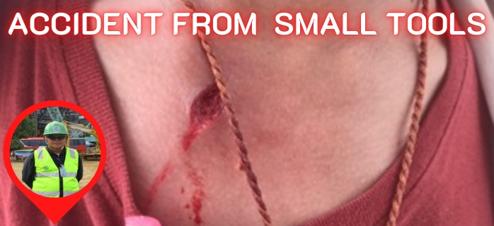 Accident from Small Tools