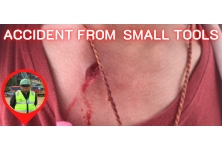 Accident from Small Tools
